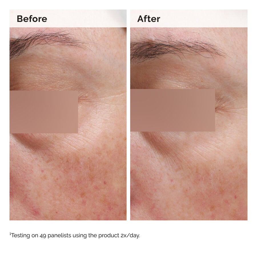 niacinamide-5-face-and-body-emulsion-q9 2024-08-23-ORD-Nia-5pct-Face-Body-B-A-Elasticity-Global-02-1x1.jpg
