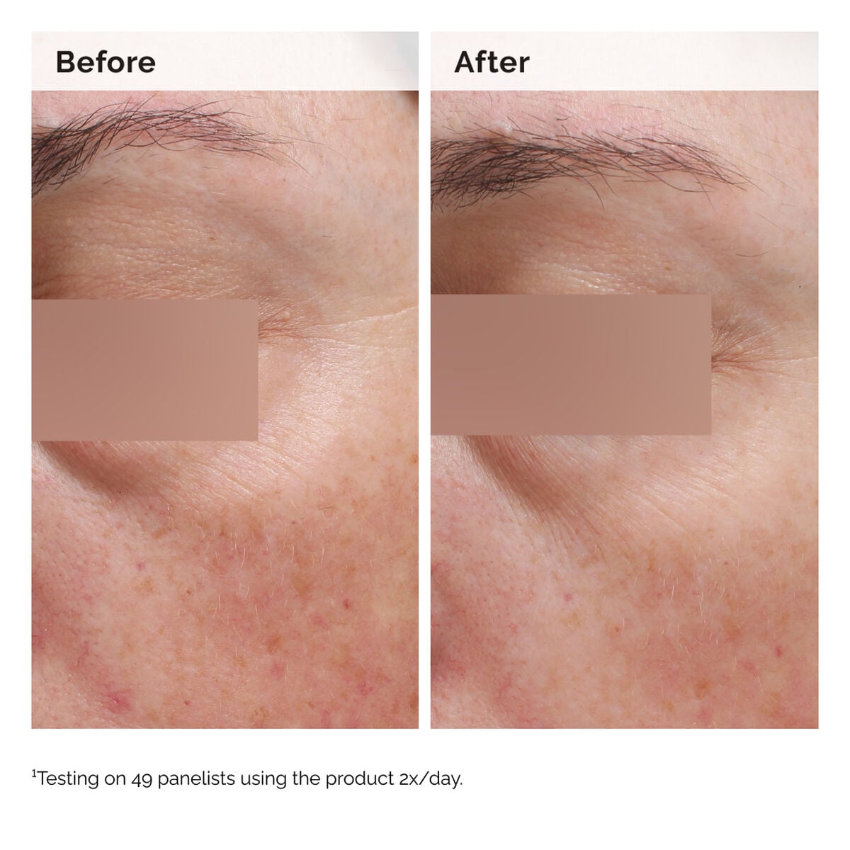 niacinamide-5-face-and-body-emulsion-q9 2024-08-23-ORD-Nia-5pct-Face-Body-B-A-Elasticity-Global-02-1x1.jpg