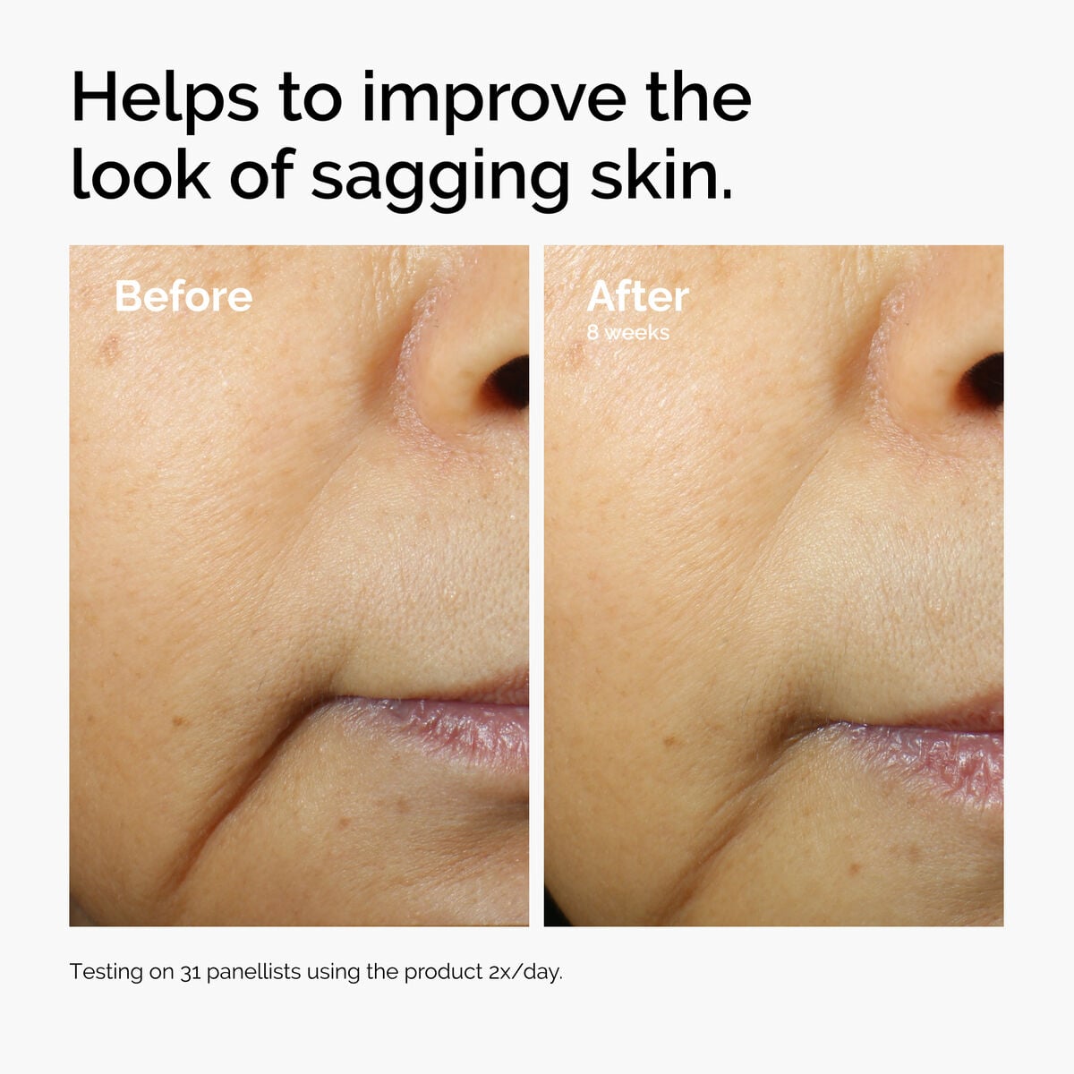 caffeine-3-escin-1-face-serum-i4 ord-caffeine-3pct-escin-1pct-face-serum-before-after-sagging.jpg