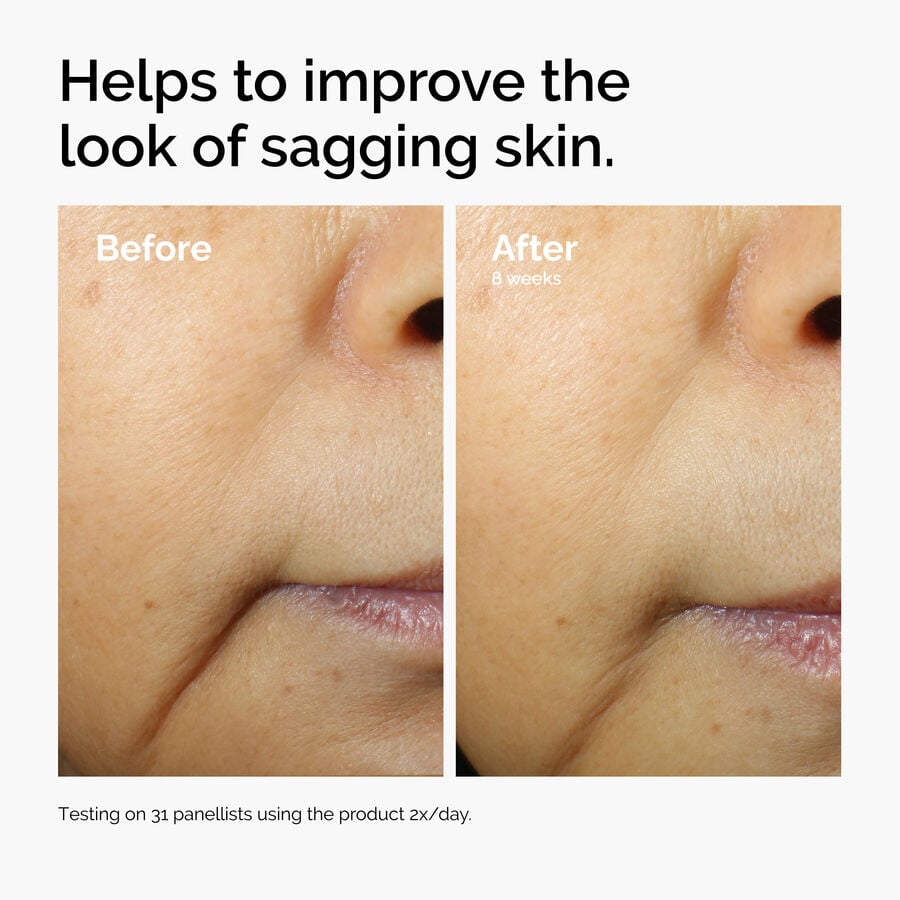 caffeine-3-escin-1-face-serum-i4 ord-caffeine-3pct-escin-1pct-face-serum-before-after-sagging.jpg