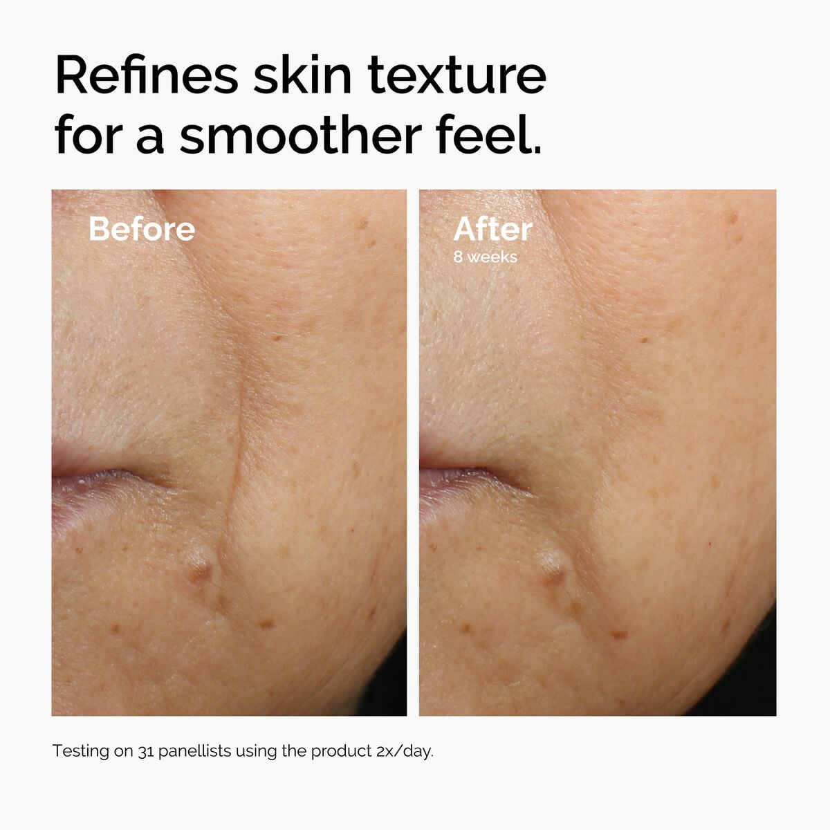 caffeine-3-escin-1-face-serum-i4 ord-caffeine-3pct-escin-1pct-face-serum-before-after-texture.jpg
