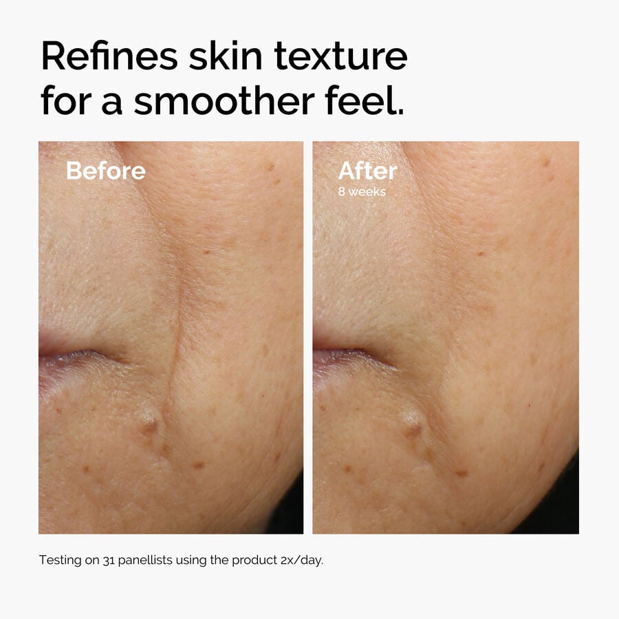 caffeine-3-escin-1-face-serum-i4 ord-caffeine-3pct-escin-1pct-face-serum-before-after-texture.jpg