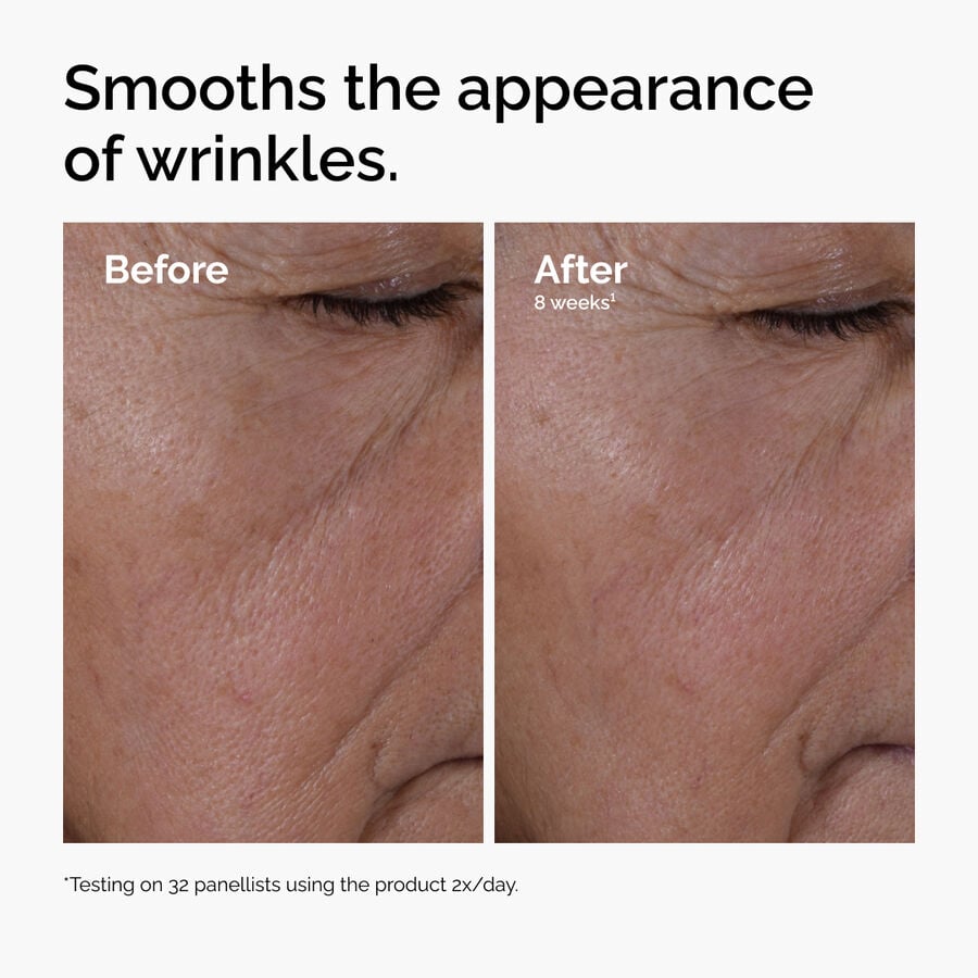 multi-peptide-ha-serum-i1 ord-multi-peptide-ha-serum-wrinkles-before-after.jpg